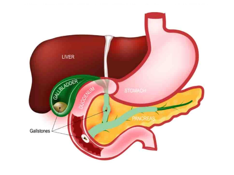 gallbladder