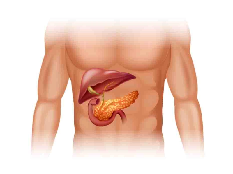 pancreatic_cancer